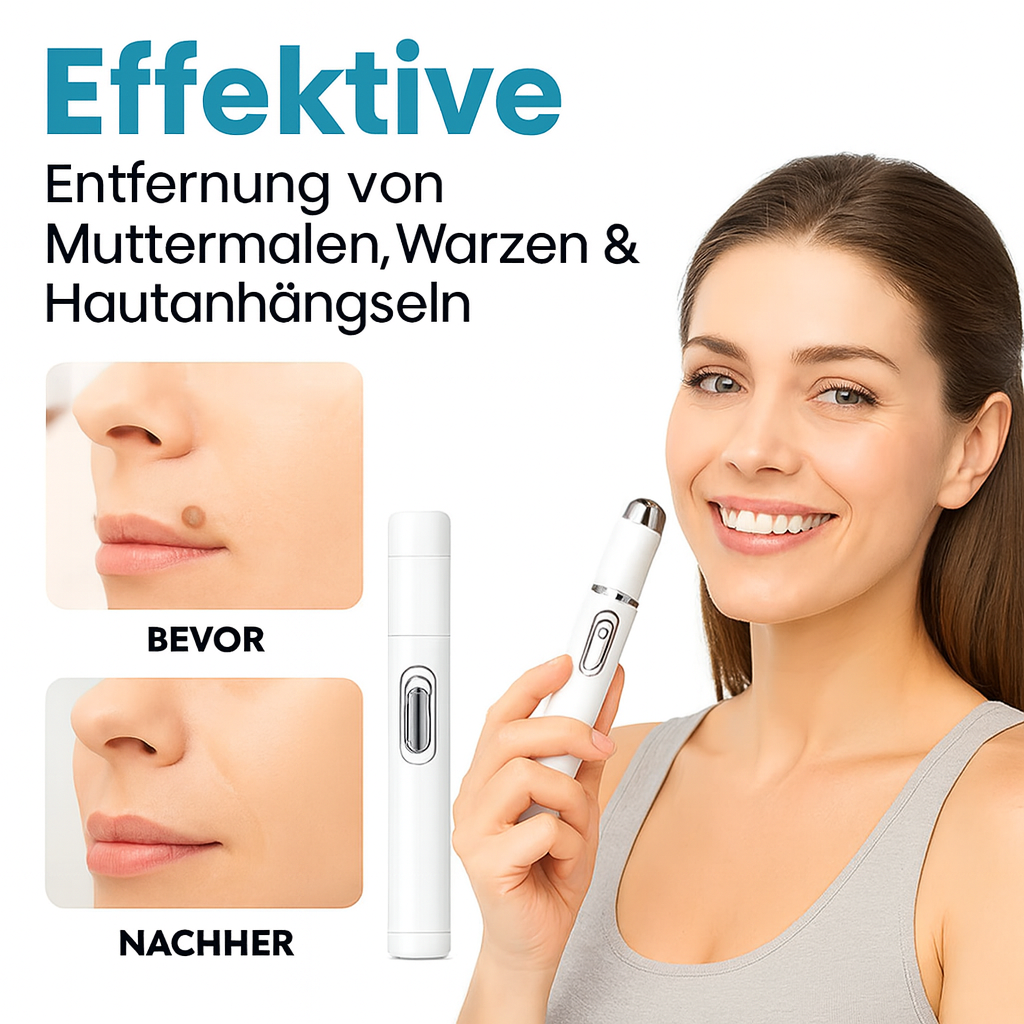 FinezoCare™ - Skin laser - 1+1 GRATIS