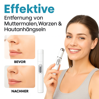 FinezoCare™ - Skin laser - 1+1 GRATIS